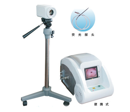 固有荧光早期肿瘤诊断仪
