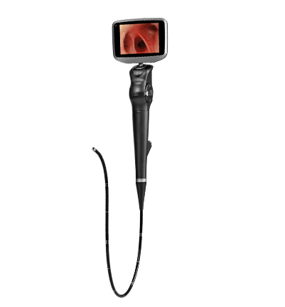 电子支气管内窥镜