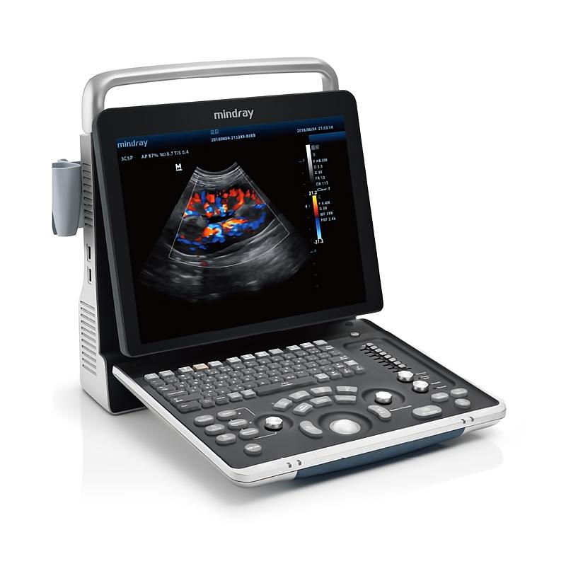 便携式彩色多普勒超声系统