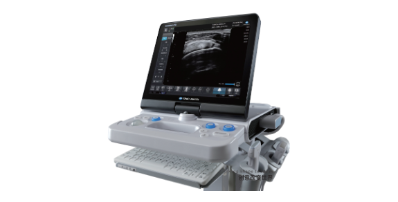 超声诊断系统