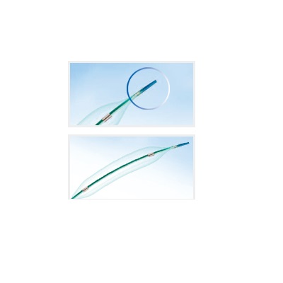 预装血管支架系统