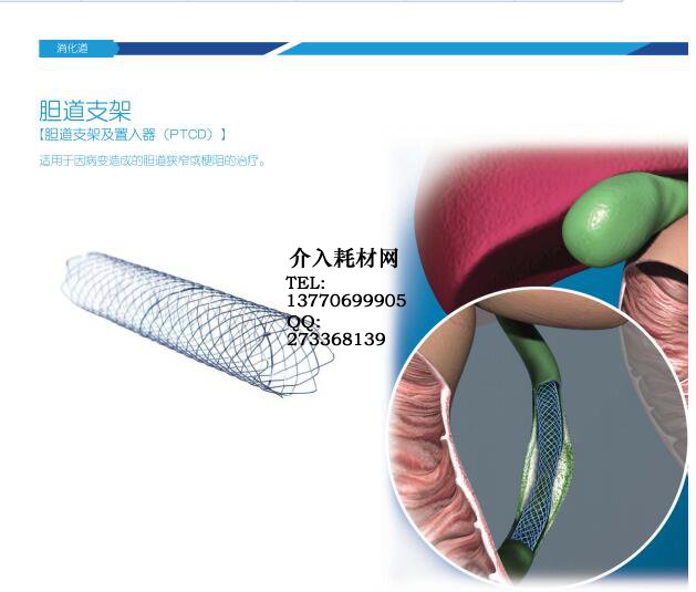 胆道支架(巴德)