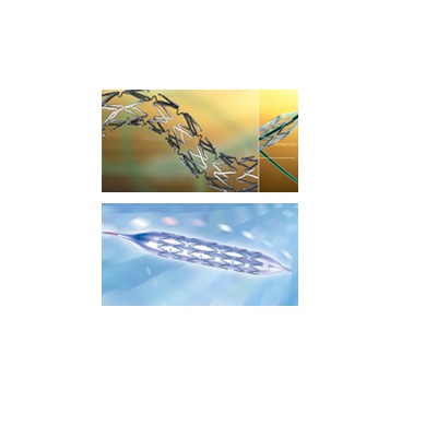 颅内动脉支架系统