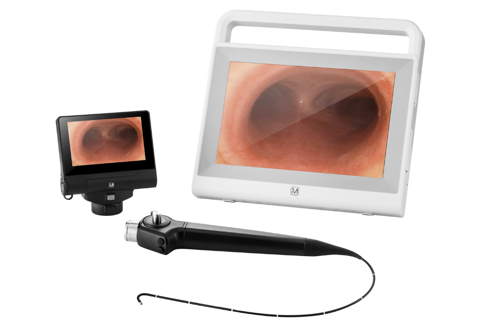 电子鼻咽喉内窥镜