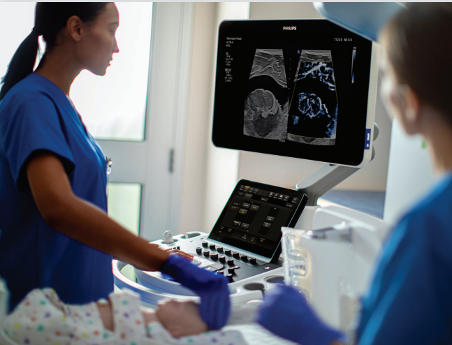 彩色超声诊断系统