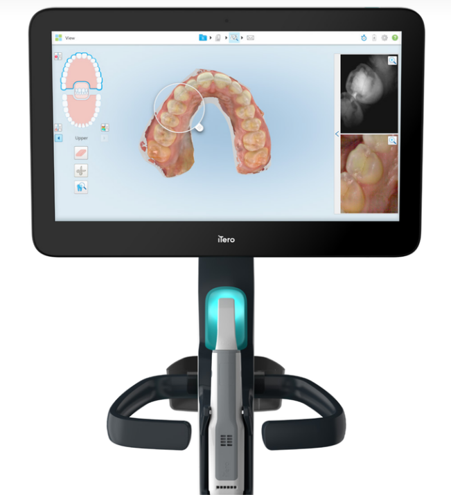 口腔数字印模仪