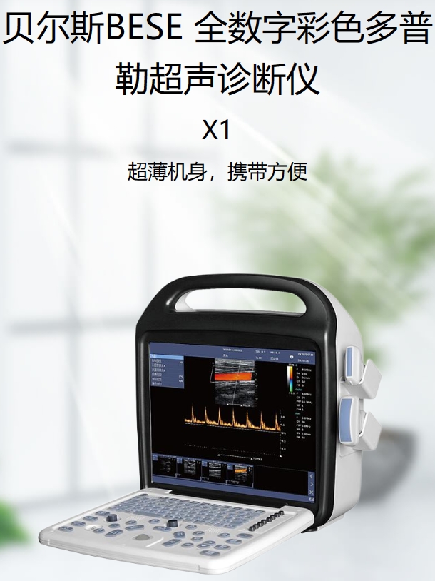 全数字彩色多普勒超声诊断仪