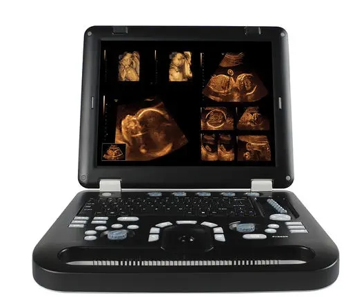 彩色多普勒超声诊断系统