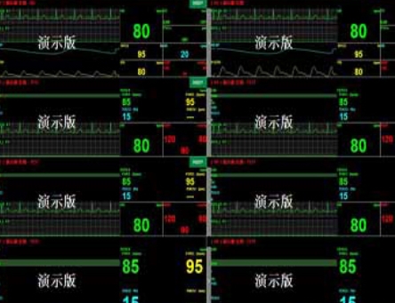 血氧心电设备数据管理软件