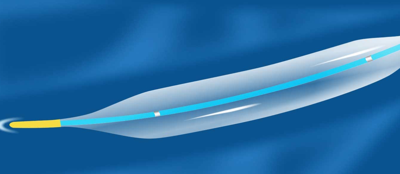 冠状动脉球囊扩张导管