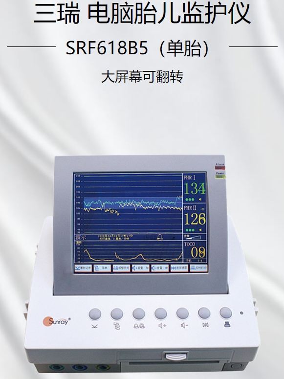 电脑胎儿监护仪