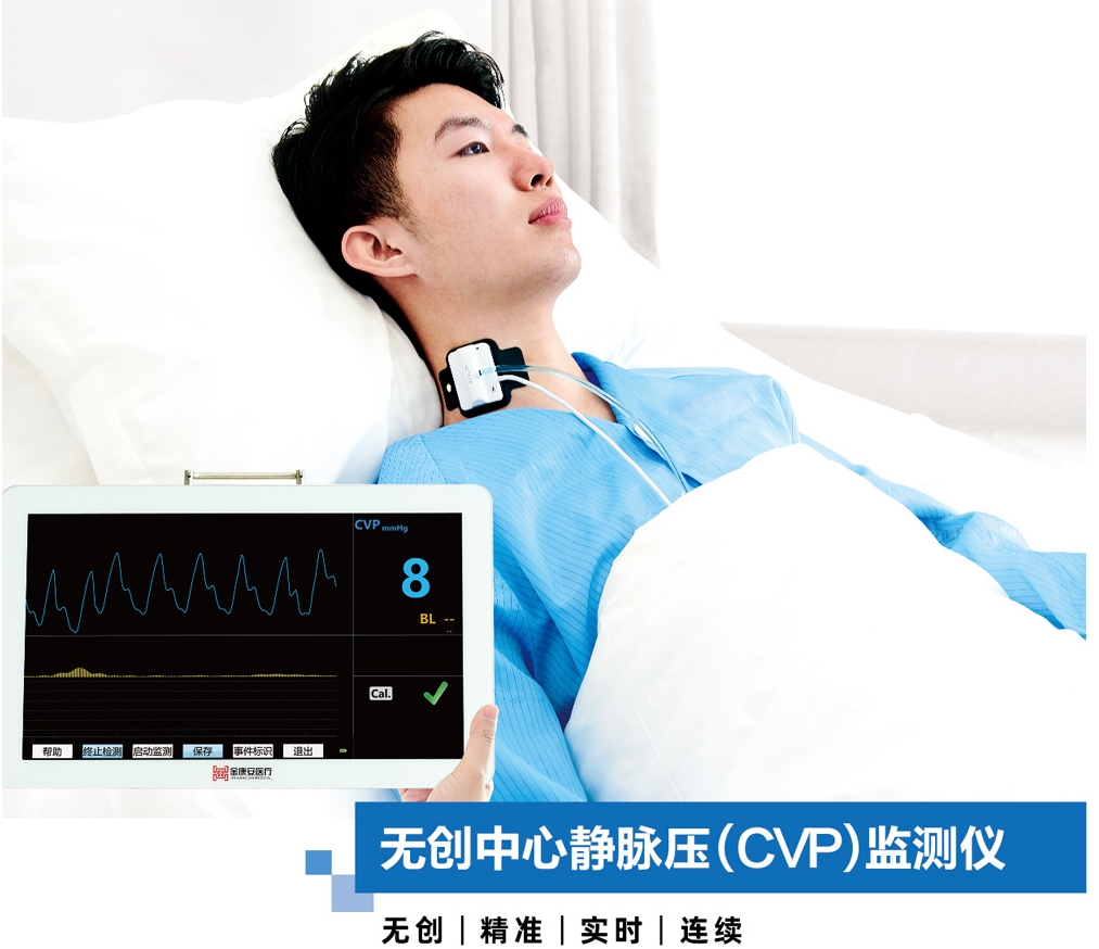 无创中心静脉压测压套件