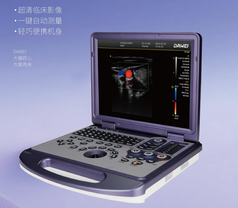 笔记本式彩色多普勒超声诊断仪（肌骨超声）