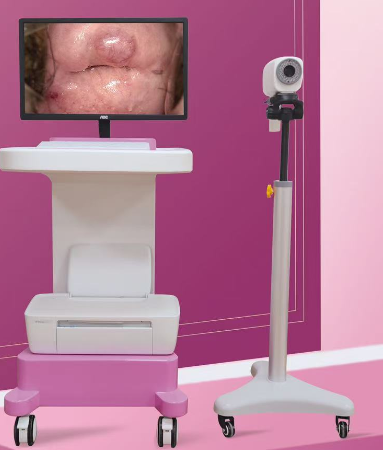 数码电子阴道镜