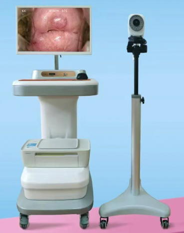 数码电子阴道镜