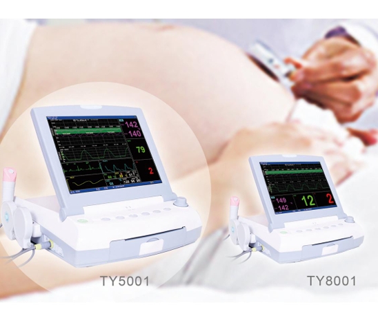 胎儿/母亲监护仪