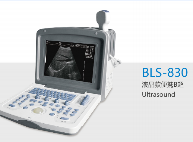 全数字超声诊断仪