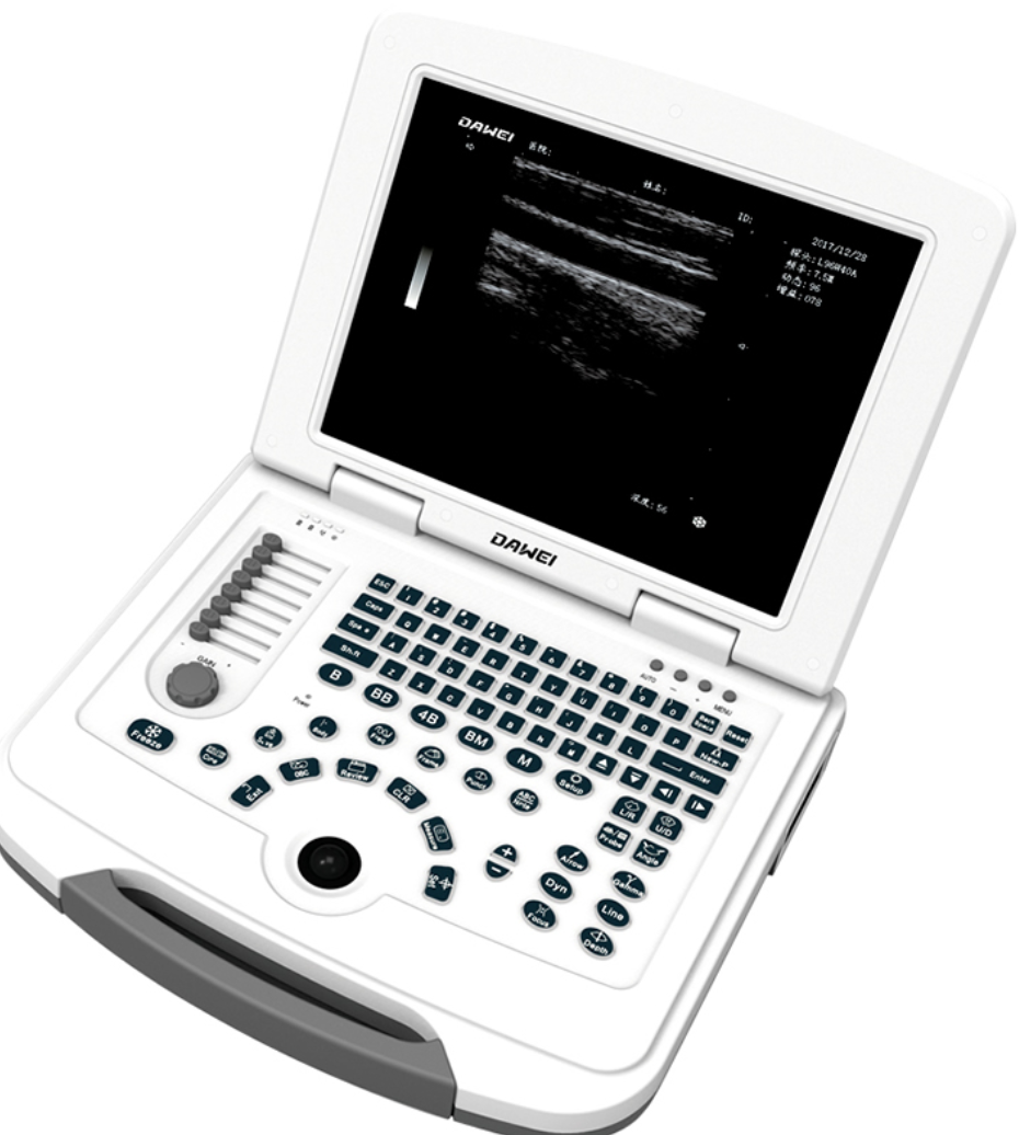 笔记本数字超声诊断仪