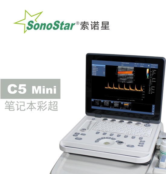全数字彩色多普勒超声诊断系统（笔记本彩超）