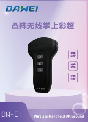 无线掌上彩色多普勒超声诊断仪