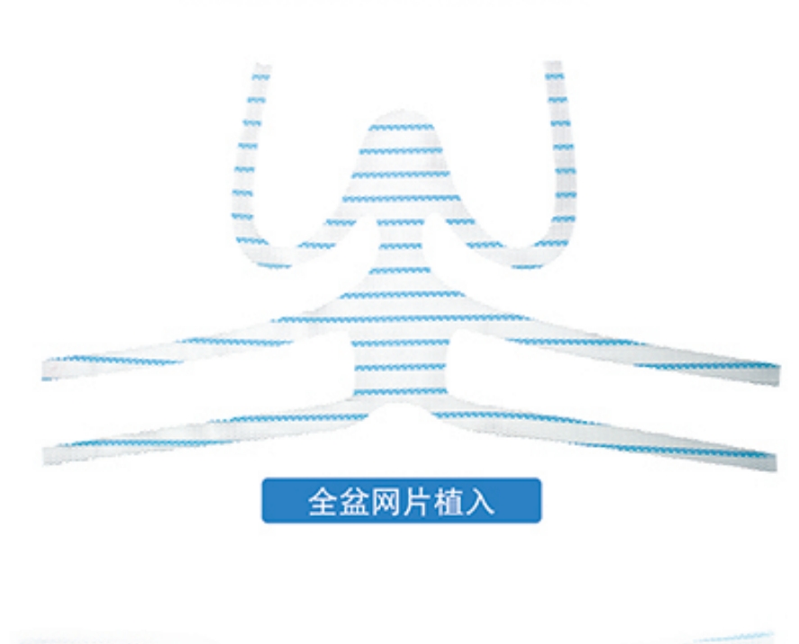 尿失禁悬吊带