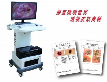 皮肤毛发观察仪