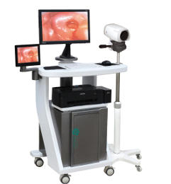 数码电子阴道镜