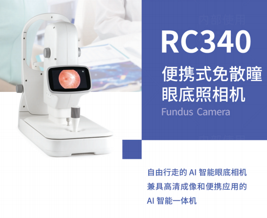 便携式免散瞳眼底照相机
