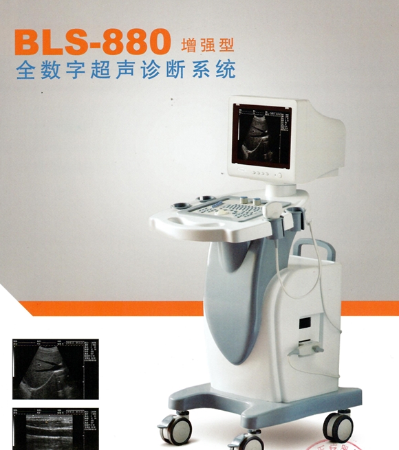 全数字超声诊断系统