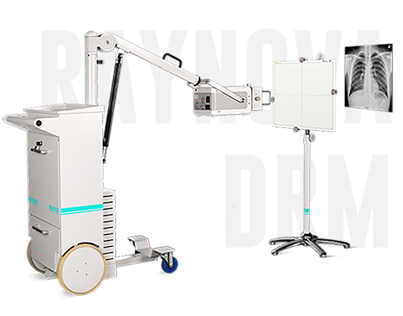 移动式数字化医用Ｘ射线摄影系统