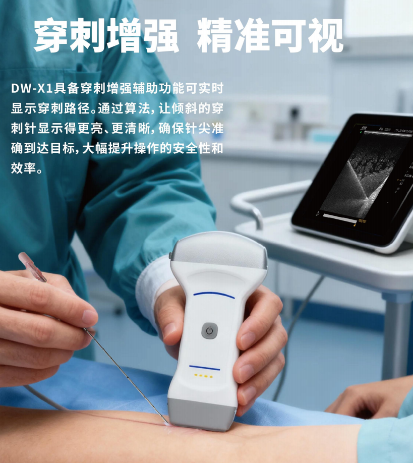 无线掌上彩色多普勒超声诊断仪