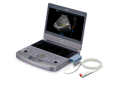 便携式彩色超声诊断系统