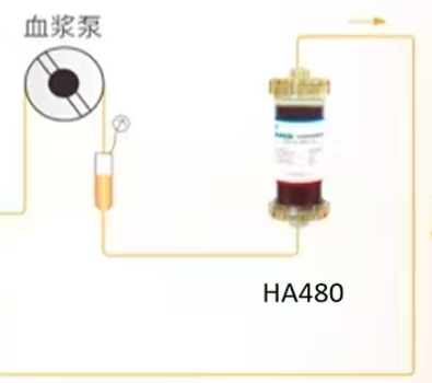 一次性使用血液灌流器