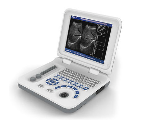 B型超声诊断仪