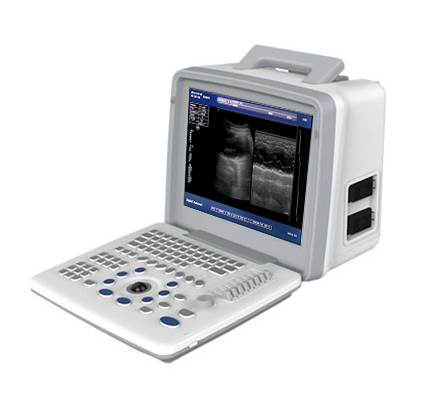 B型超声诊断仪