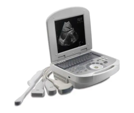 全数字超声诊断系统
