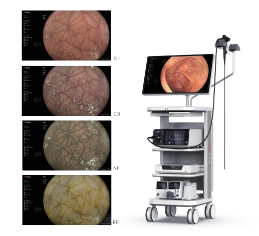电子内窥镜图像处理器(胃肠镜系统