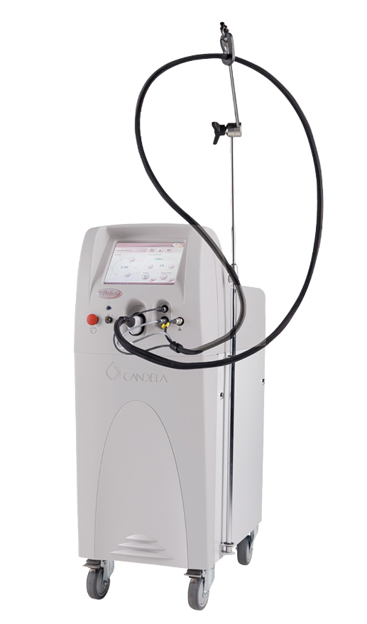 最佳脉冲染料激光系统血管治疗