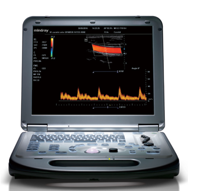 便携式彩色多普勒超声系统