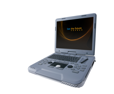 全数字彩色多普勒超声诊断系统