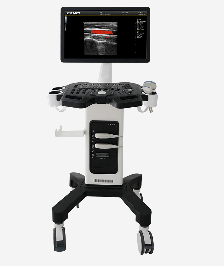 推车式彩色多普勒超声诊断仪