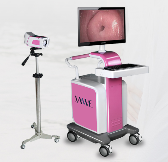 数字光学阴道镜