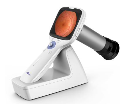 便携式眼底照相机