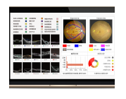 眼科影像存储处理与分析系统