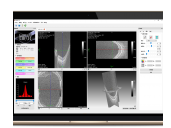眼科OCT圖像輔助診斷軟件