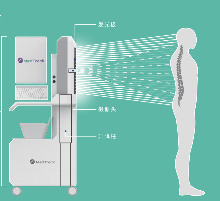 3D打印脊柱侧弯支具设备方案