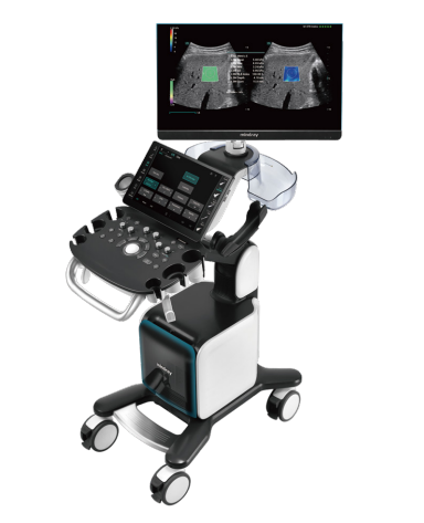 彩色多普勒超声系统