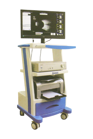 眼科超声诊断仪