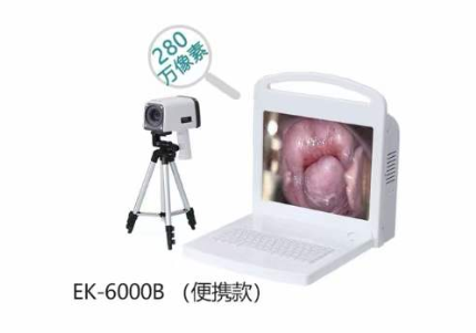 数码电子阴道镜